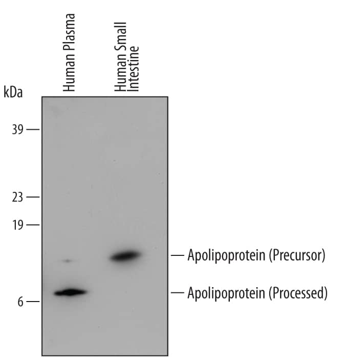 Detection of Human Apolipoprotein C-II/ApoC2 antibody by Western Blot.