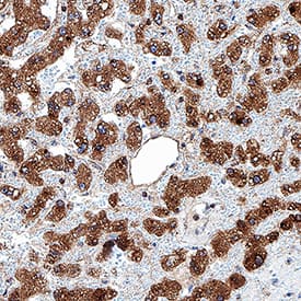 Apolipoprotein C-II/ApoC2 antibody in Human Liver by Immunohistochemistry (IHC-P).