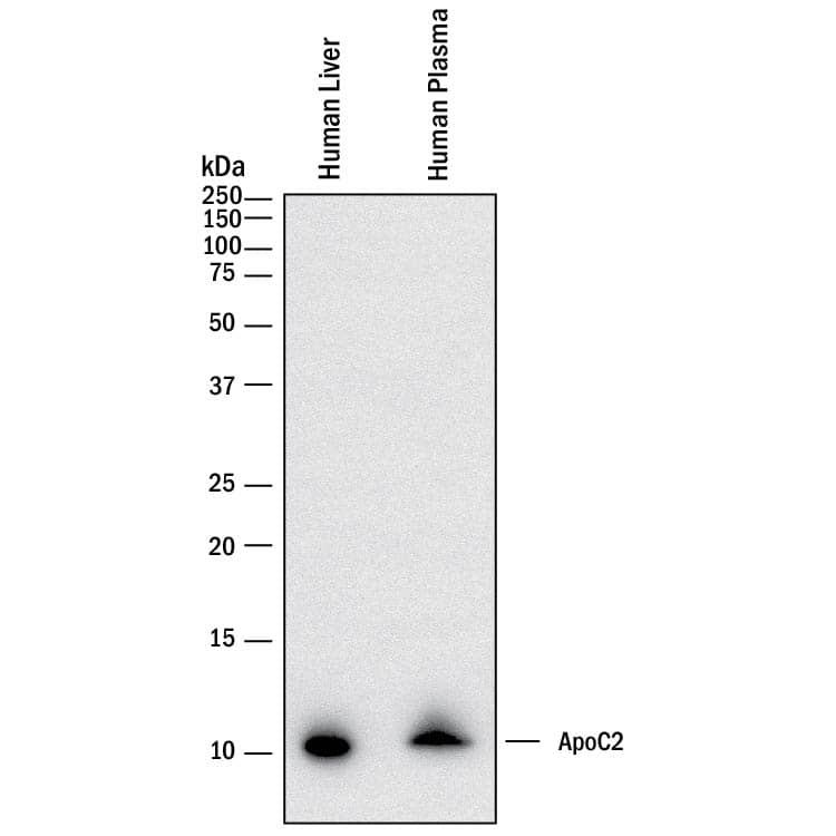 Detection of Human Apolipoprotein C-II/ApoC2 antibody by Western Blot.