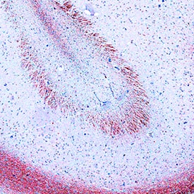 Apolipoprotein E3/ApoE3 antibody in Human Brain by Immunohistochemistry (IHC-P).