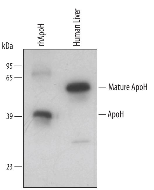 Detection of Human Apolipoprotein H/ApoH antibody by Western Blot.