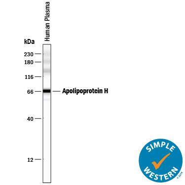 Detection of Human Apolipoprotein H/ApoH antibody by Simple WesternTM.