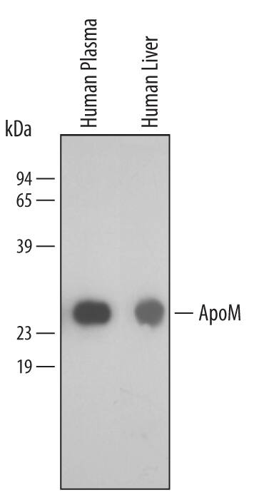 Detection of Human Apolipoprotein M/ApoM antibody by Western Blot.