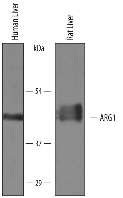 Detection of Human and Rat Arginase 1/ARG1 antibody by Western Blot.