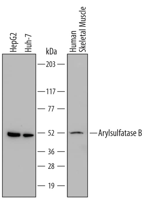 Detection of Human Arylsulfatase B/ARSB antibody by Western Blot.