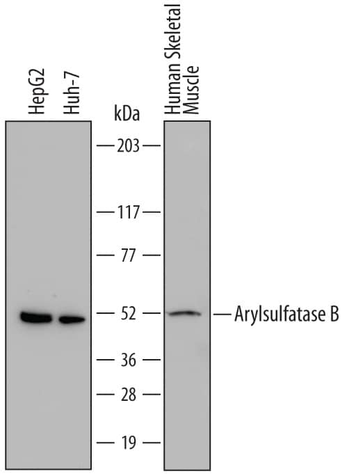 Detection of Human Arylsulfatase B/ARSB antibody by Western Blot.