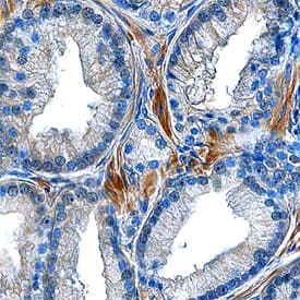 Atrial Natriuretic Peptide/ANP antibody in Human Prostate by Immunohistochemistry (IHC-P).