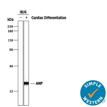 Detection of Human Atrial Natriuretic Peptide/ANP antibody by Simple WesternTM.