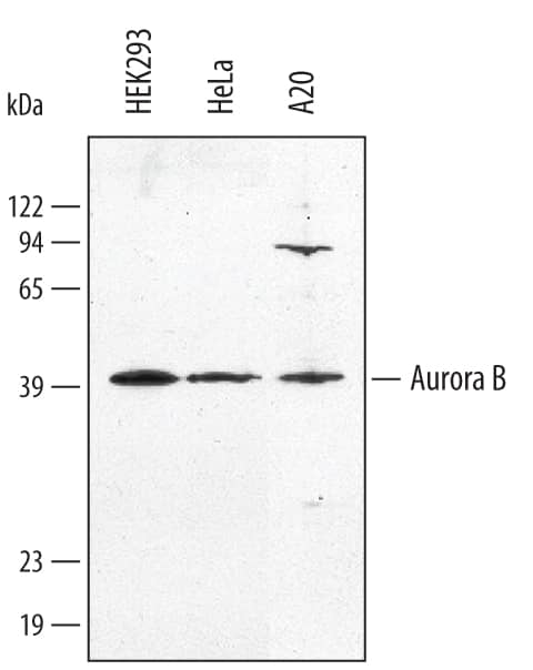 Detection of Human Aurora B antibody by Western Blot.