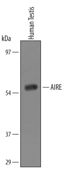 Detection of Human Autoimmune Regulator/AIRE antibody by Western Blot.