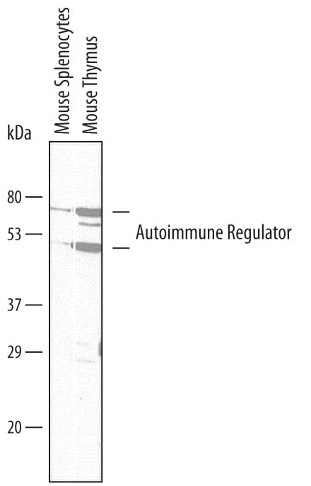 Detection of Mouse Autoimmune Regulator/AIRE antibody by Western Blot.