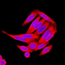 Axin-2 antibody in SW480 Human Cell Line by Immunocytochemistry (ICC).