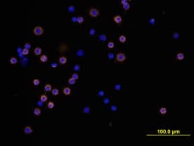 B220/CD45R antibody in Mouse Splenocytes by Immunocytochemistry (ICC).