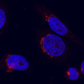 beta-1,4-Galactosyltransferase 1/B4GalT1 antibody in HeLa Human Cell Line by Immunocytochemistry (ICC).