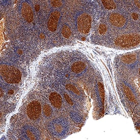 B7-1/CD80 antibody in Human Tonsil by Immunohistochemistry (IHC-P).