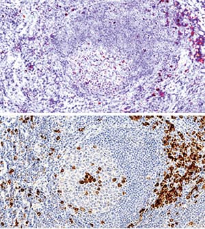 B7-1/CD80 antibody in Human Tonsil Using Dual RNAscope®ISH and IHC.
