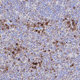 B7-1/CD80 antibody in Human Tonsil by Immunohistochemistry (IHC-P).