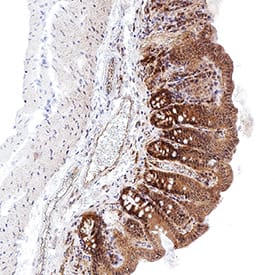 B7-1/CD80 antibody in Mouse Colon Tissue by Immunohistochemistry (IHC-P).