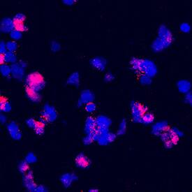 B7-H7/HHLA2 antibody in Human PBMCs by Immunocytochemistry (ICC).