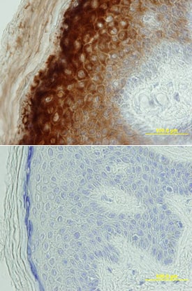 BACE-2 antibody in Human Skin by Immunohistochemistry (IHC-P).