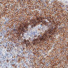 BAFF R/TNFRSF13C antibody in Human Spleen by Immunohistochemistry (IHC-P).