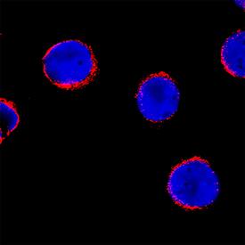 BAK antibody in Jurkat Human Cell Line by Immunocytochemistry (ICC).