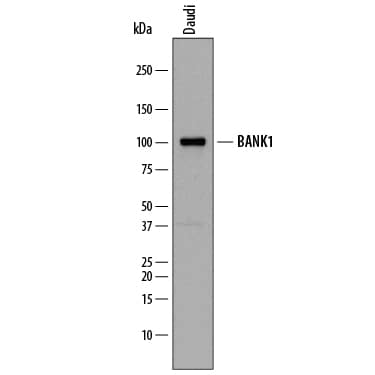 Detection of Human BANK1 antibody by Western Blot.