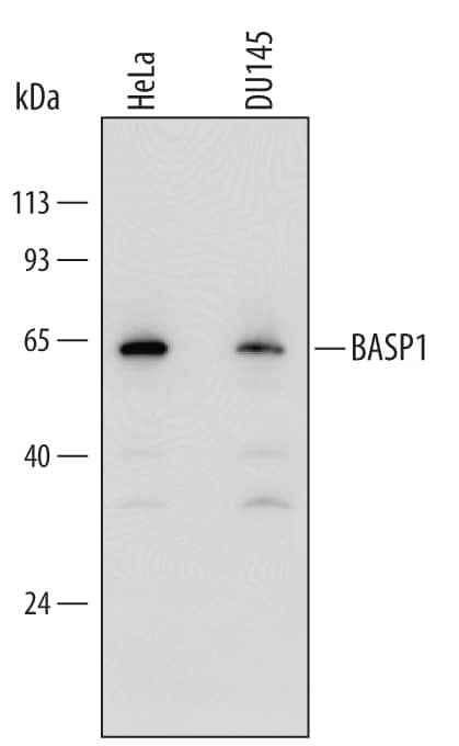 Detection of Human BASP1 antibody by Western Blot.