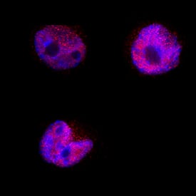 BATF3 antibody in HDLM-2 Human Cell Line by Immunocytochemistry (ICC).