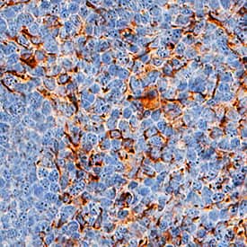 BCMA/TNFRSF17 antibody in Human Tonsil by Immunohistochemistry (IHC-P).