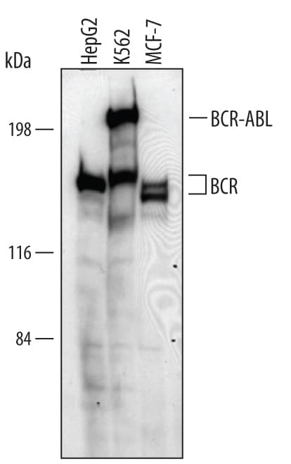 Detection of Human BCR antibody by Western Blot.