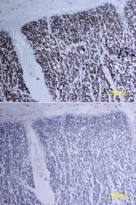 BDNF antibody in Human Spinal Cord by Immunohistochemistry (IHC-P).