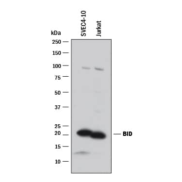 Detection of Human and Mouse BID antibody by Western Blot.