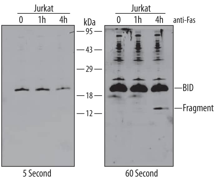 Detection of Human BID antibody by Western Blot.