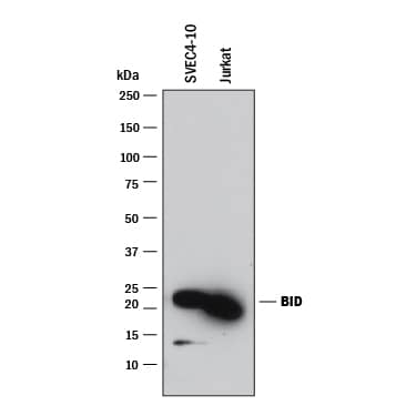 Detection of Human and Mouse BID antibody by Western Blot.