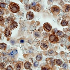 BIMLin Human Spleen by Immunohistochemistry (IHC-P).