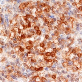 BLNK antibody in Human Spleen by Immunohistochemistry (IHC-P).