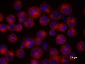 BMI-1 antibody in K562 Human Cell Line by Immunocytochemistry (ICC).