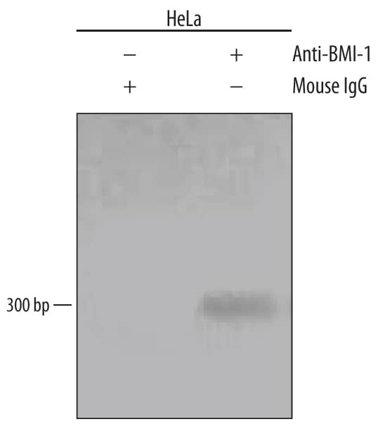 Detection of BMI-1-regulated Genes antibody by Chromatin Immunoprecipitation.