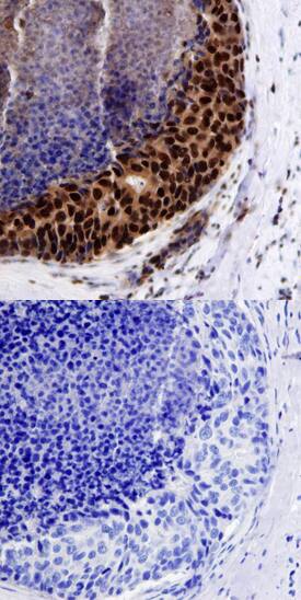 BMI-1 antibody in Human Breast by Immunohistochemistry (IHC-P).