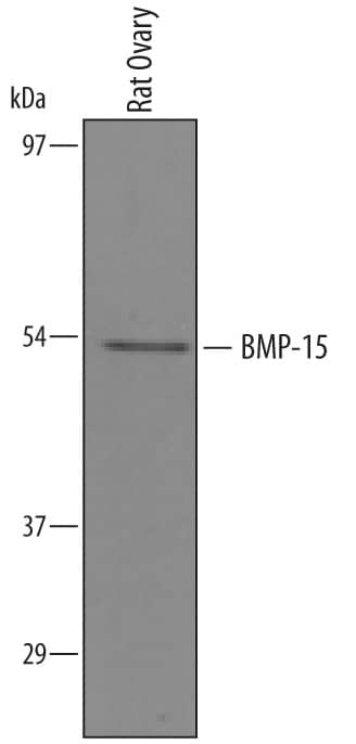 Detection of Rat BMP-15/GDF-9B antibody by Western Blot.