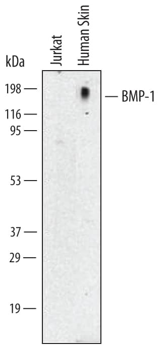 Detection of Human BMP-1/PCP antibody by Western Blot.