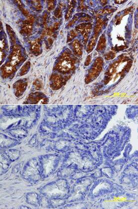 BMP-7 antibody in Human Prostate by Immunohistochemistry (IHC-P).