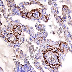 BMP-6 antibody in Human Lung by Immunohistochemistry (IHC-P).