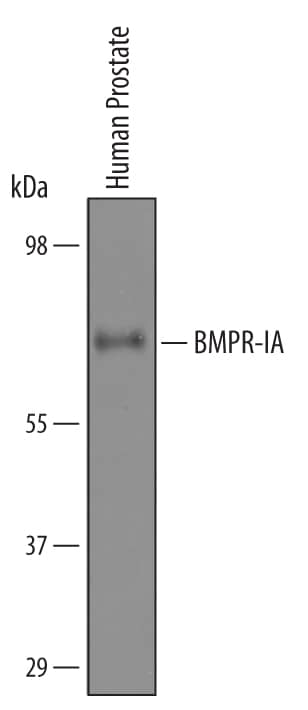 Detection of Human BMPR-IA/ALK-3 antibody by Western Blot.