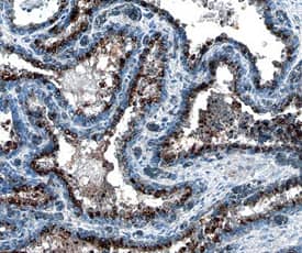 BMPR-IA/ALK-3 antibody in Human Prostate by Immunohistochemistry (IHC-P).