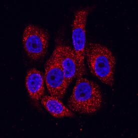 BMPR-IB/ALK-6 antibody in PC-3 Human Cell Line by Immunocytochemistry (ICC).