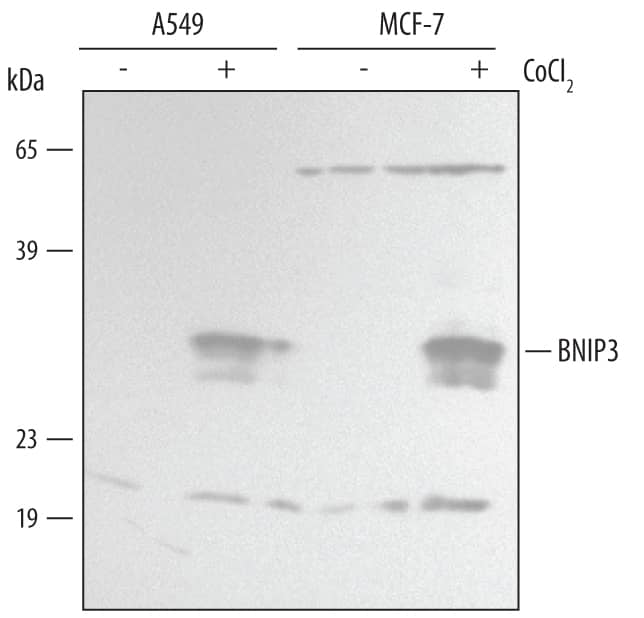 Detection of Human BNIP3 antibody by Western Blot.