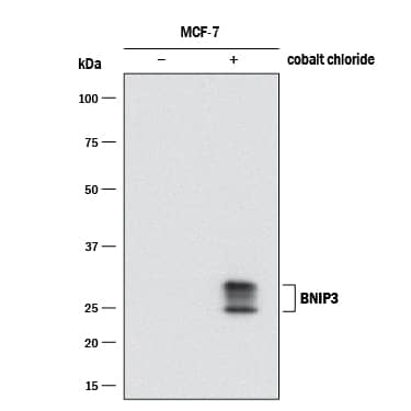 Detection of Human BNIP3 antibody by Western Blot.