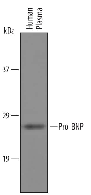 Detection of Human Pro-BNP antibody by Western Blot.